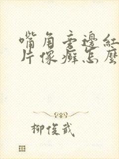 嘴角旁边红色一片像癣怎么办