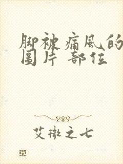 脚被痛风的症状图片 部位