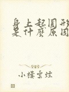 身上起圆形的癣是什么原因