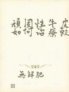 顽固性牛皮有癣如何治疗较好