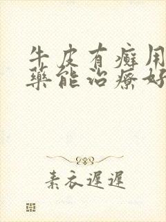 牛皮有癣用什么药能治疗好