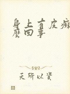 身上有皮癣是怎么回事