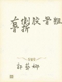 右侧股骨粗隆下骨折封面