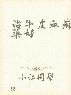 治牛皮血癣什么药好