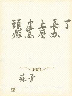 头皮上长了一块癣怎么办