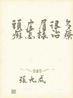 头皮屑很多又块癣怎样治疗