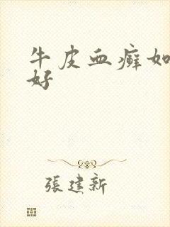 牛皮血癣如何治好