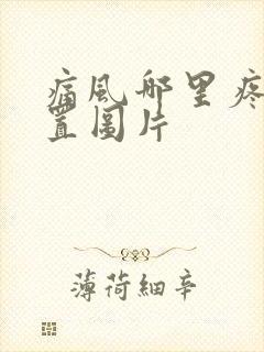 痛风哪里疼痛位置图片