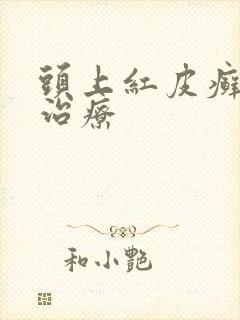 头上红皮癣怎么治疗