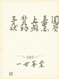 手背上长圆圈形状的癣怎么回事?封面