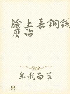 脸上长铜钱癣怎么治