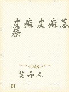 皮癣皮癣怎么治疗