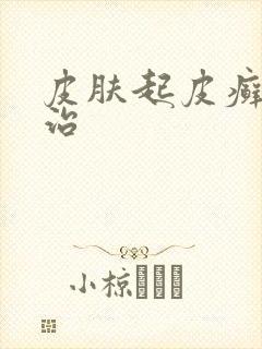 皮肤起皮癣怎么治