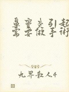 鼻窦炎引起头疼需要做手术吗