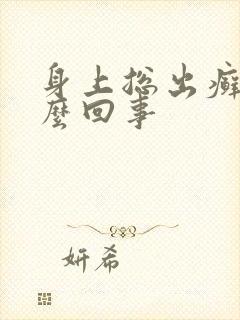 身上总出癣是怎么回事封面