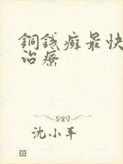 铜钱癣最快土方治疗