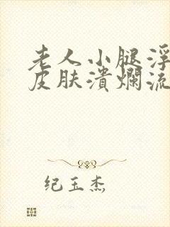 老人小腿浮肿且皮肤溃烂流水