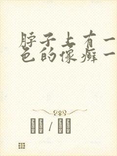 脖子上有一块红色的像癣一样封面