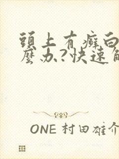 头上有癣白皮怎么办?快速解决