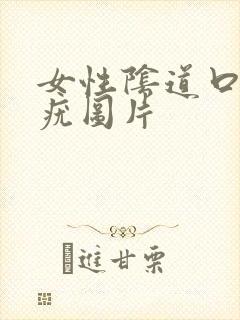 女性阴道口湿锐疣图片