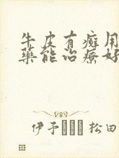 牛皮有癣用什么药能治疗好封面