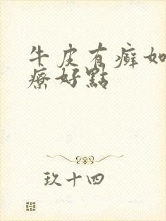 牛皮有癣如何治疗好点