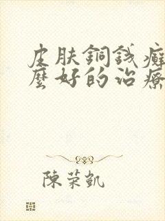 皮肤铜钱癣有什么好的治疗办法