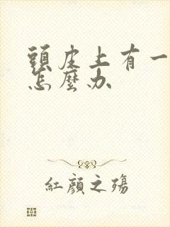 头皮上有一块癣怎么办