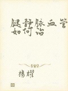 腿静脉血管曲张如何治