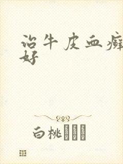 治牛皮血癣怎么好