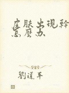 皮肤出现干燥癣怎么办