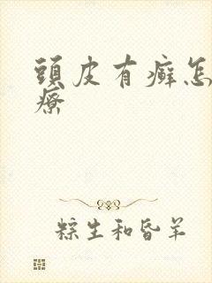 头皮有癣怎么治疗