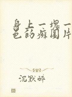 身上一块一块红色的癣图片