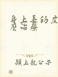 身上长的皮癣怎么治疗