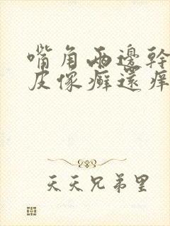 嘴角两边干燥脱皮像癣还痒