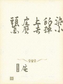 头皮上的染发膏怎么去掉小妙招