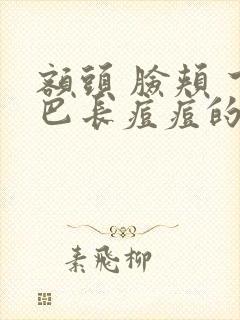 额头 脸颊 下巴长痘痘的原因