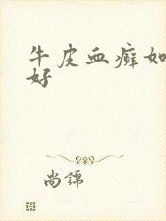 牛皮血癣如何治好