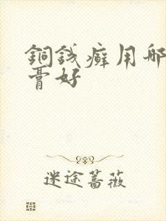 铜钱癣用哪种药膏好