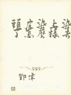 头皮染上染发剂了怎么样去除