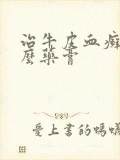 治牛皮血癣用什么药膏