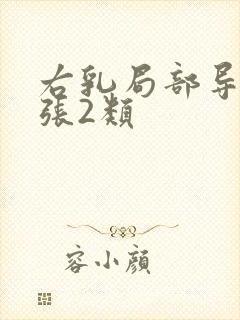 右乳局部导管扩张2类