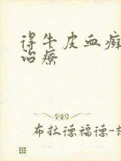 得牛皮血癣怎样治疗