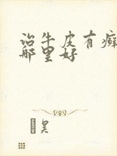 治牛皮有癣医院哪里好