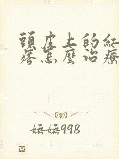 头皮上的红色疙瘩怎么治疗