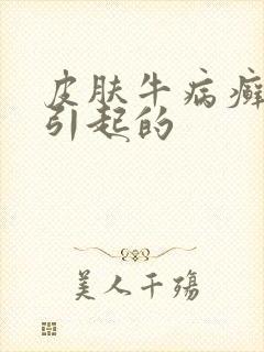 皮肤牛病癣怎么引起的