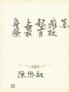 身上起癣怎么治疗最有效封面