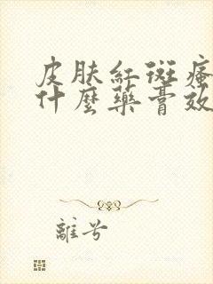 皮肤红斑瘙痒用什么药膏效果好