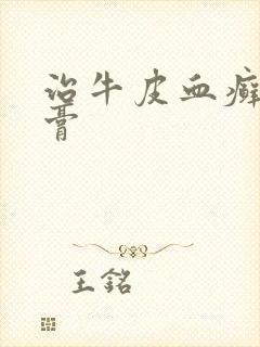 治牛皮血癣的药膏