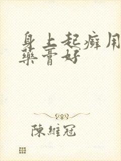 身上起癣用什么药膏好